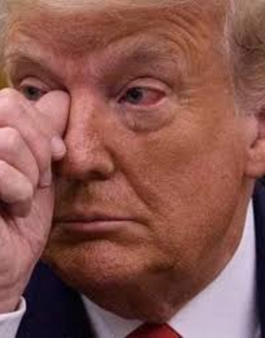 Dermatologists Explain the Red Patch on Donald Trump’s Neck