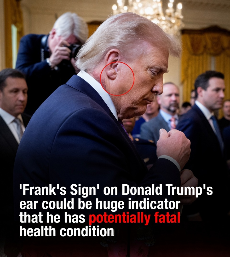 ‘Frank’s Sign’ on Trump’s ear could be huge indicator of potentially fatal health condition