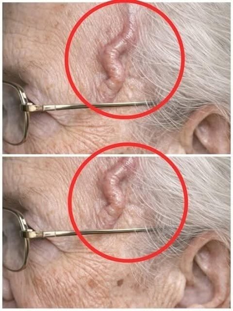 These are the first symptoms of a... See more