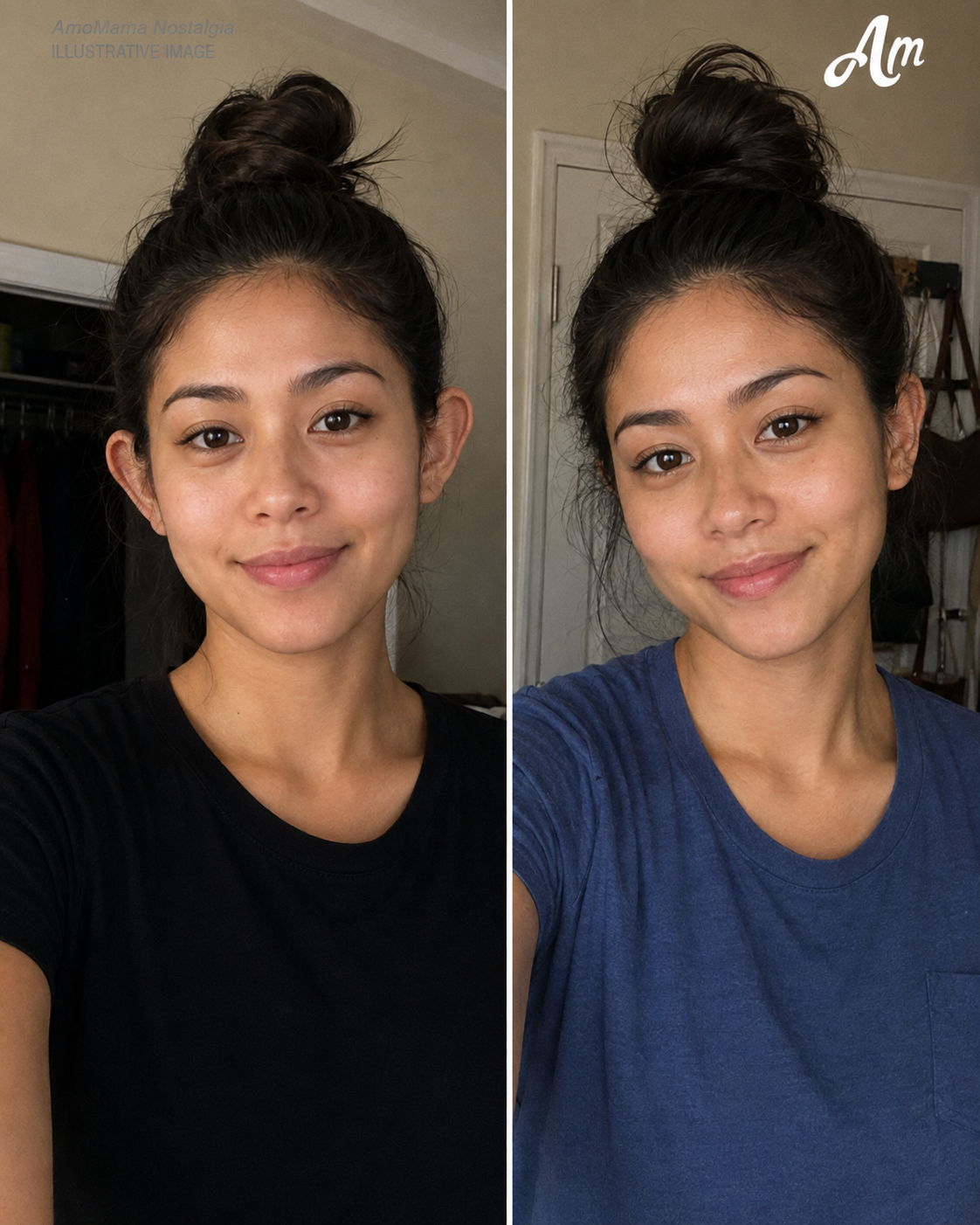Sumailalim Ako sa Plastic Surgery para Ayusin ang mga Tainga na Minalto sa Akin sa Buong Buhay Ko – Ngunit Pag-uwi Ko, Isang Pagtingin Lang sa Akin ng Aking Ina at Napaluha