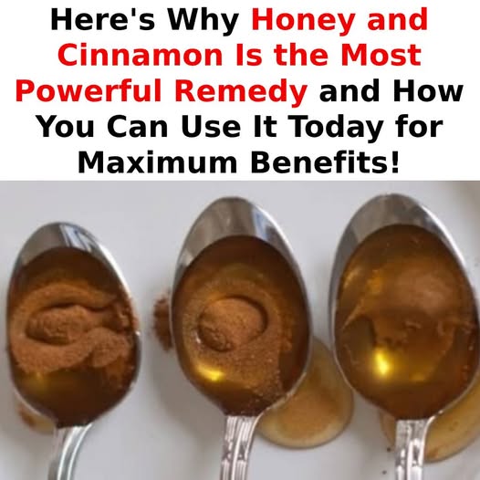Cinnamon and Honey: Most Powerful Remedy That Not Even Doctors Can Explain