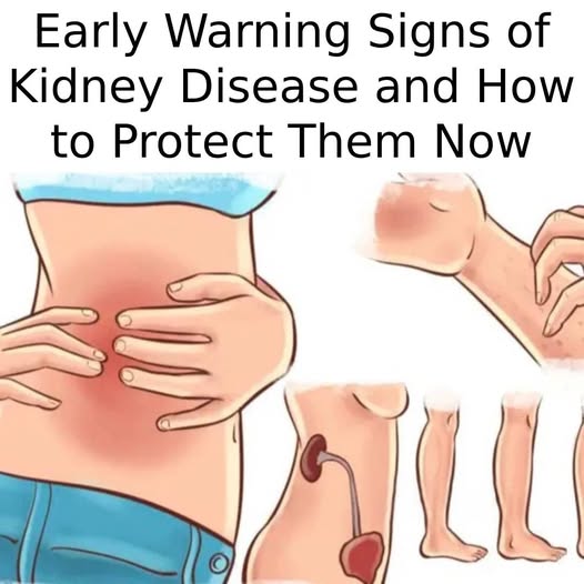 Doctors Reveal 14 Hidden Signs You Have Kidney Problems (Don't Ignore Them)