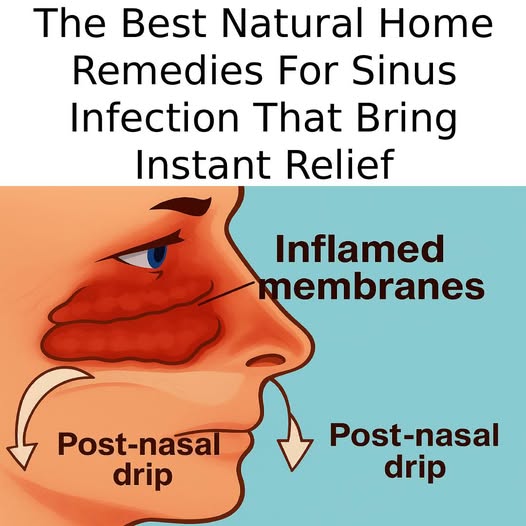 8 Natural Ways to Beat a Sinus Infection, No Antibiotics Required