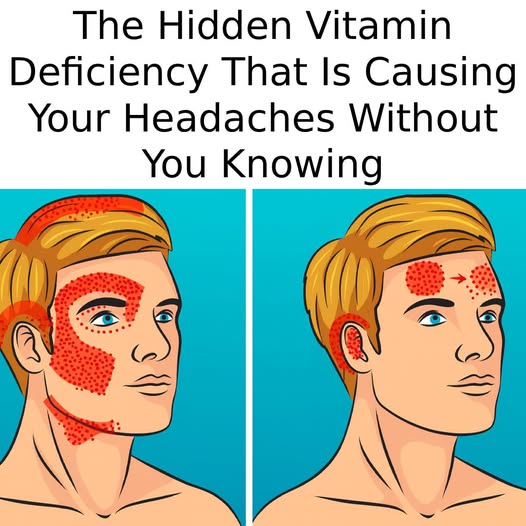 The Hidden Vitamin Deficiency That Is Causing Your Headaches Without You Knowing.