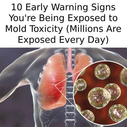 10 Early Warning Signs Of Mold Toxicity Everyone Should Know (Millions Are Exposed Every Day)