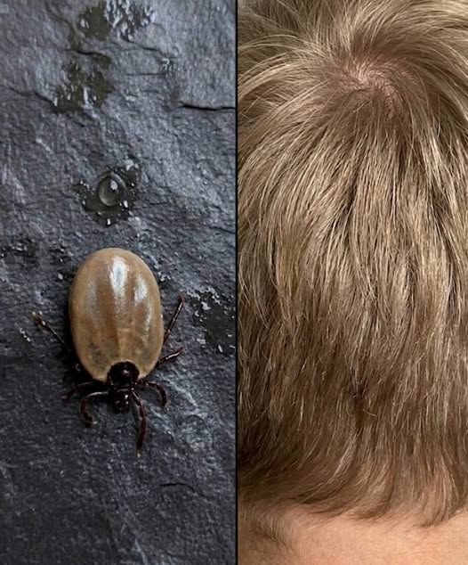 I just found it on my son's head... What is it?
