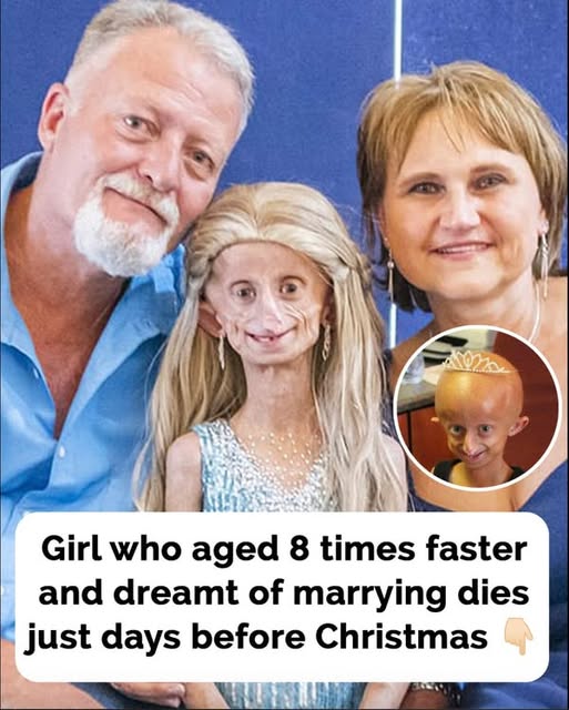 Teen who aged 8 times faster dies just before Christmas – her final message breaks our hearts