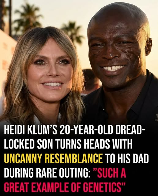 Heidi Klum's 20-year-old son attracts attention with his dreadlocks.