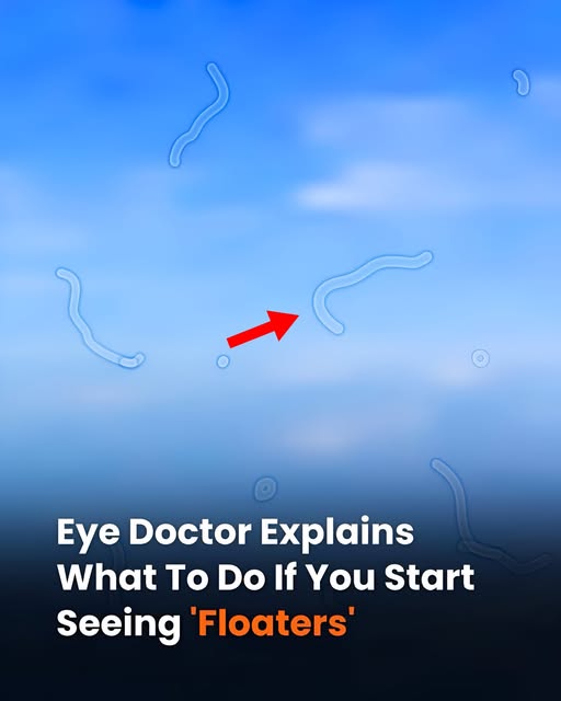Eye Doctor Explains What To Do If You Start Seeing 'Floaters'