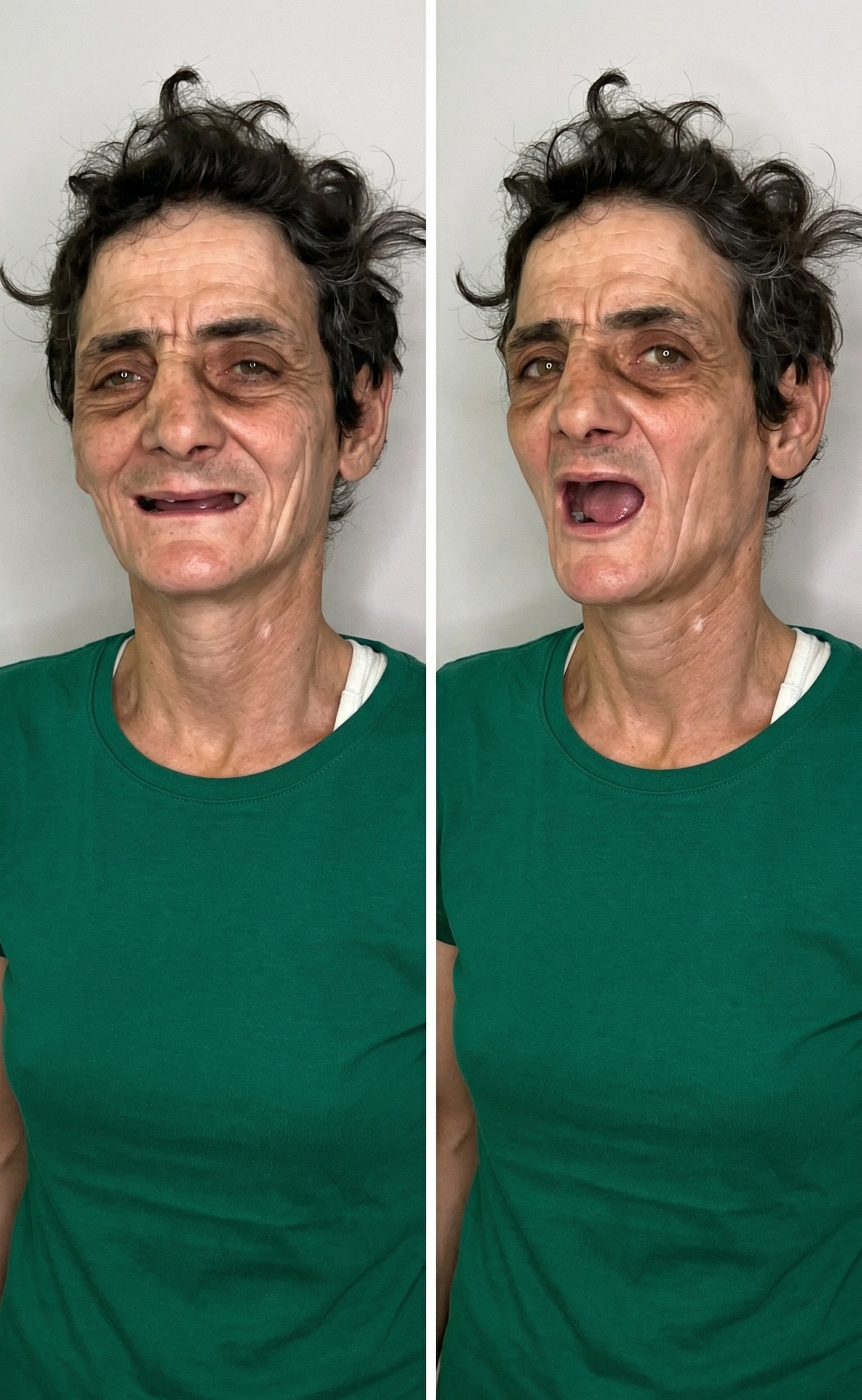 A homeless woman impresses the world