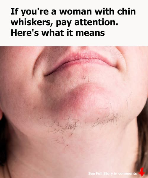 If you're a woman with chin whiskers, pay attention. Here's what it means
