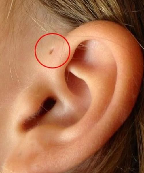 People with this ear hole have... See more