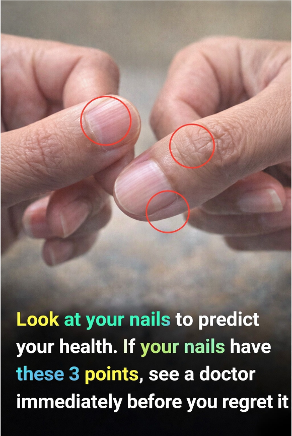How to spot health issues by looking at your nails...