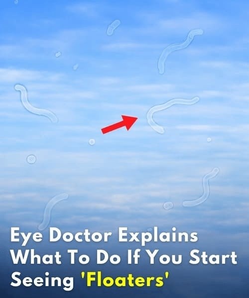 Eye Doctor Explains What To Do If You Start Seeing 'Floaters'... see more