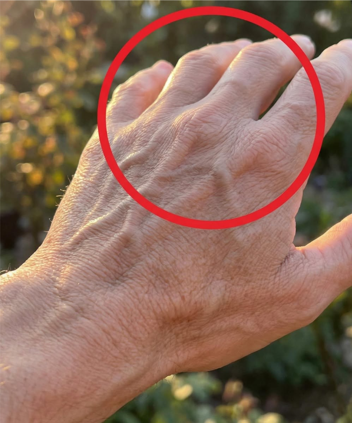 If you have visible veins it means you are...