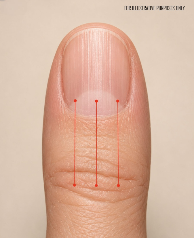 If you have lines on your nails, it means you have c...