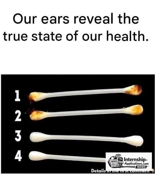The Health of Your Ears Can Offer Surprising Insights About Your Body. - Likya