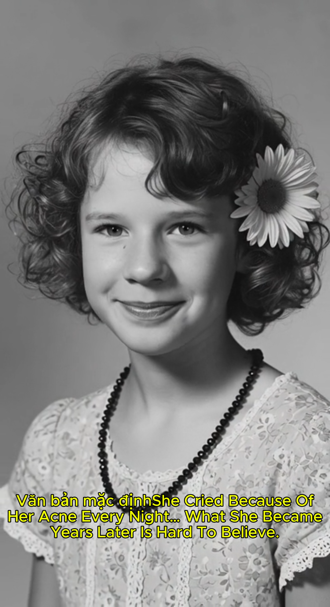 She Cried Because Of Her Acne Every Night… What She Became Years Later Is Hard To Believe.