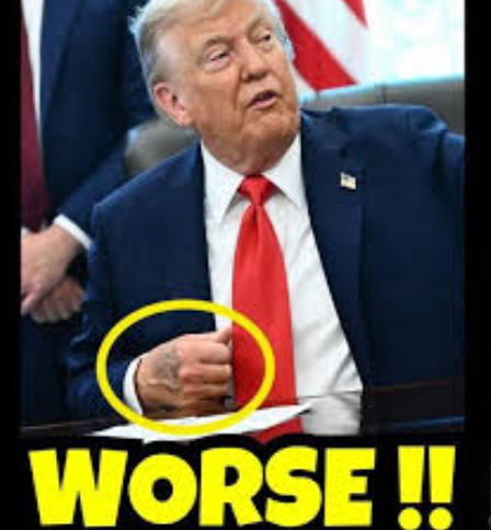 BREAKING: Karoline Leavitt confirms President’s new health battle…1