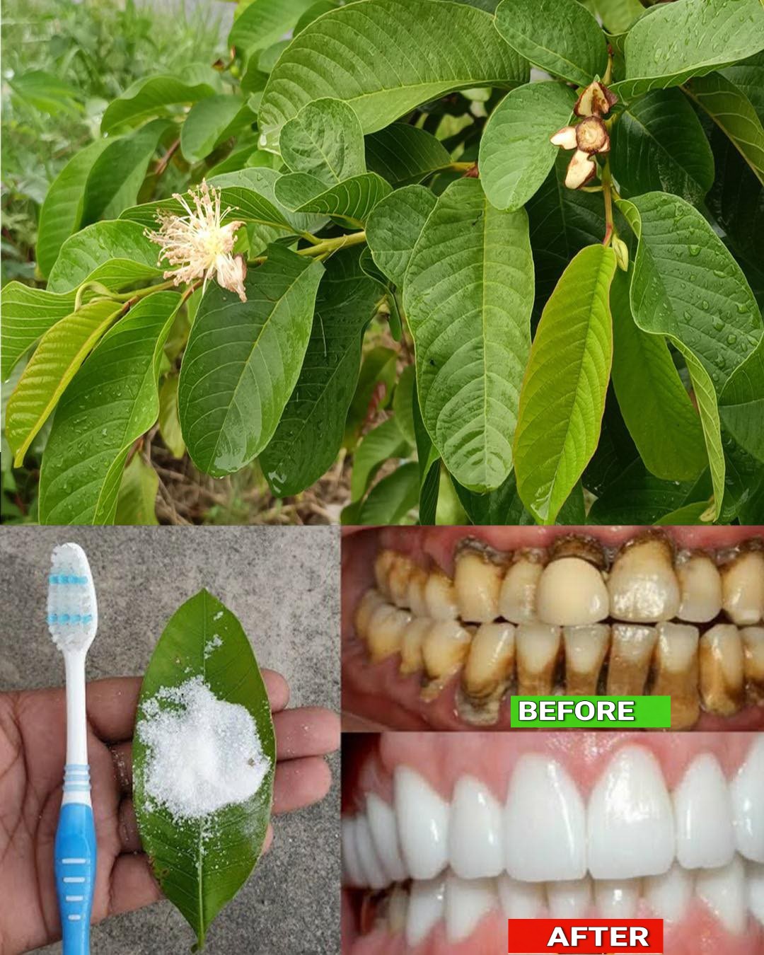 Top 3 Ways to Treat Tooth Decay with Guava Leaves – Simple and Cost-Effective