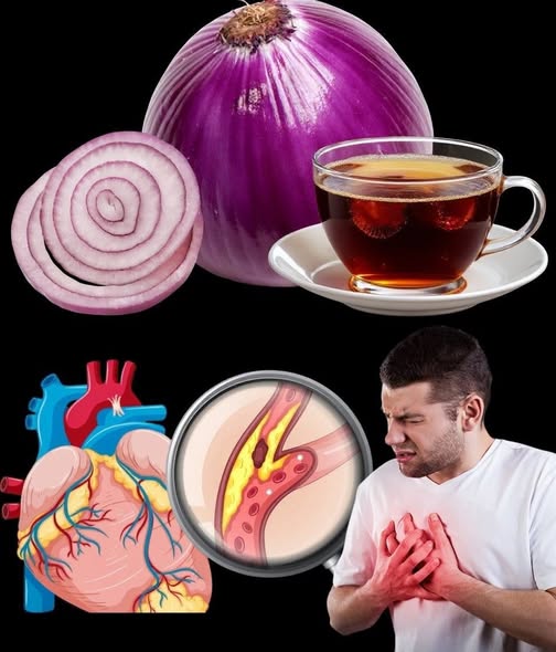 Blood Sugar Drops Instantly with This Red Onion Recipe! A True Culinary Treasure Few People Know About!
