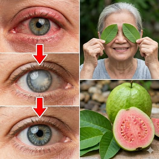 How to Use Guava to Support Eye Health: Natural Home Remedies for the Eyes