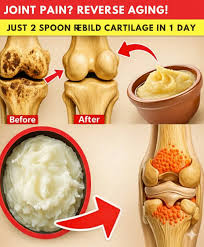 A 97-year-old orthopedic surgeon says: This food can rebuild knee cartilage in just 24 hours! !! Just click OK and I'll send you all the info cs