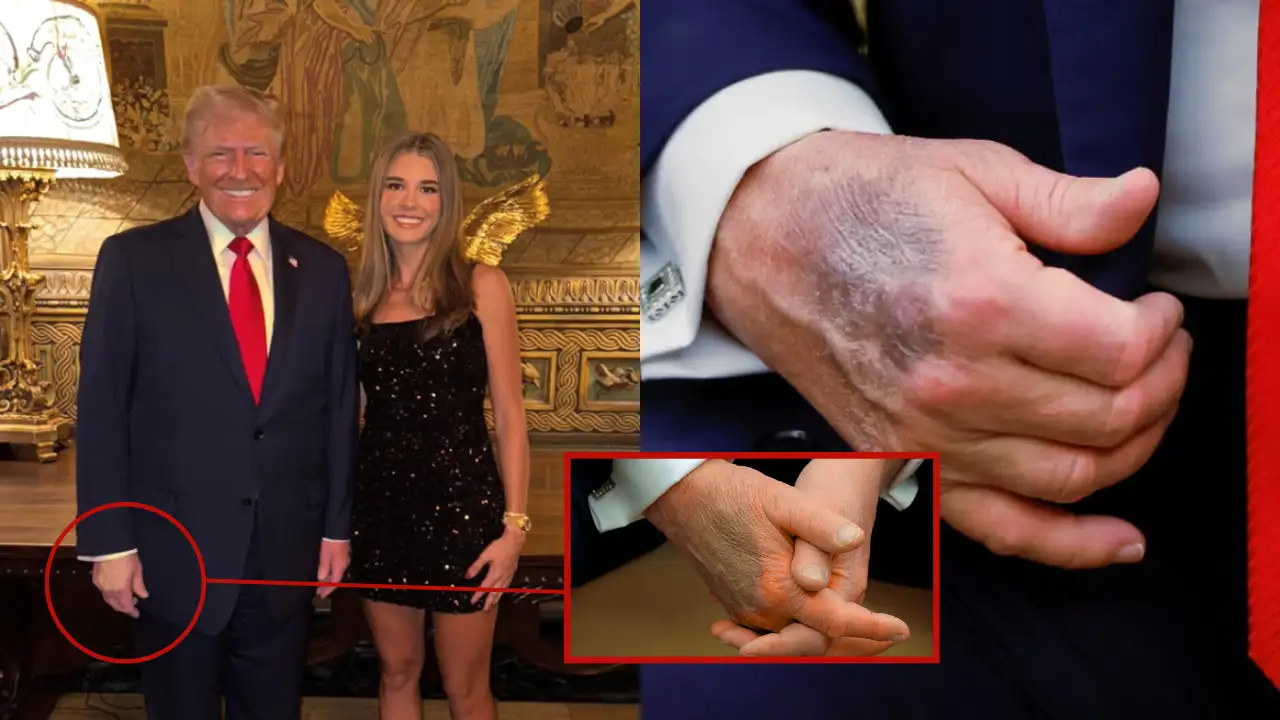 Donald Trump's admits that he tested positive for…See more