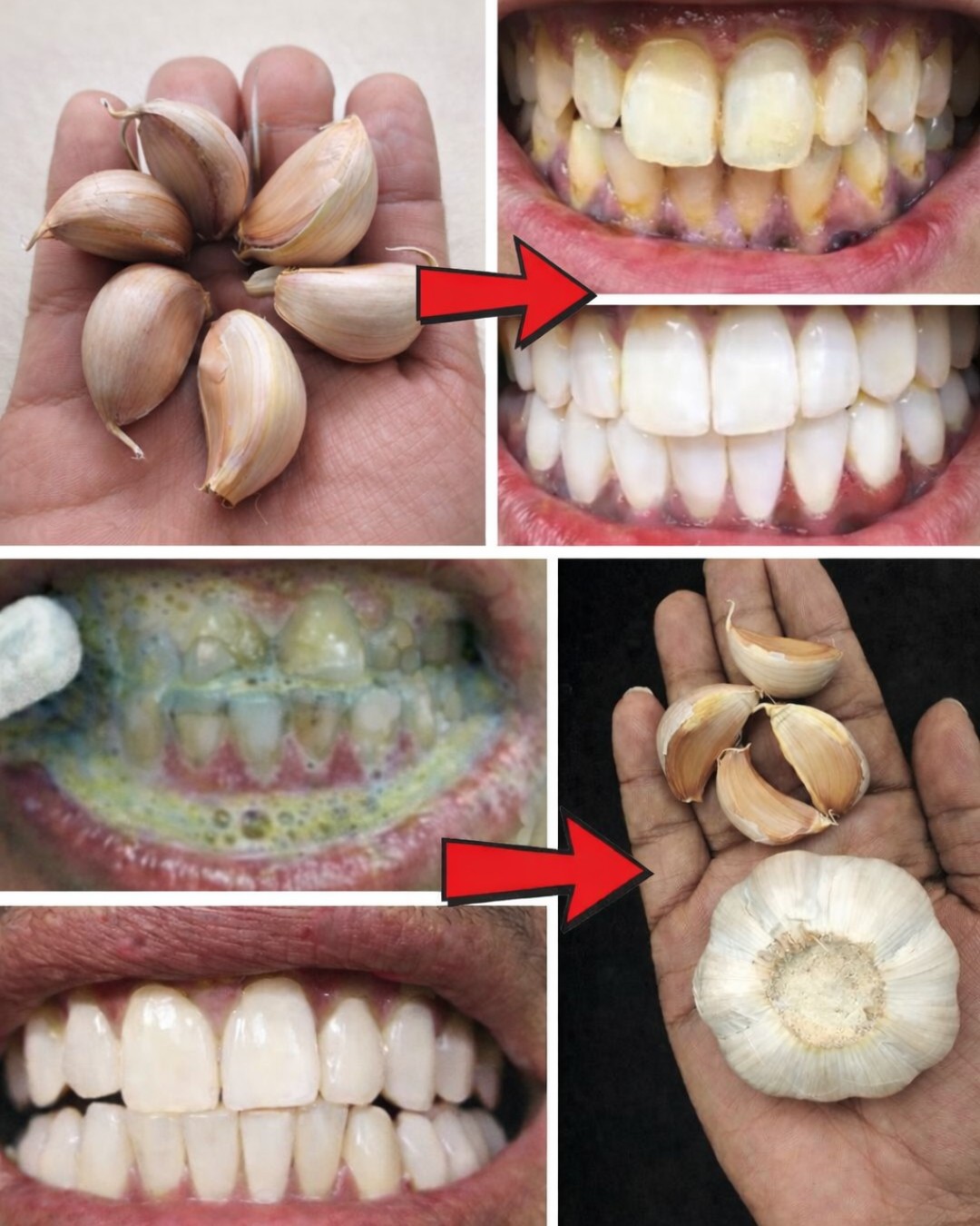Improve Your Oral Health Naturally with Garlic
