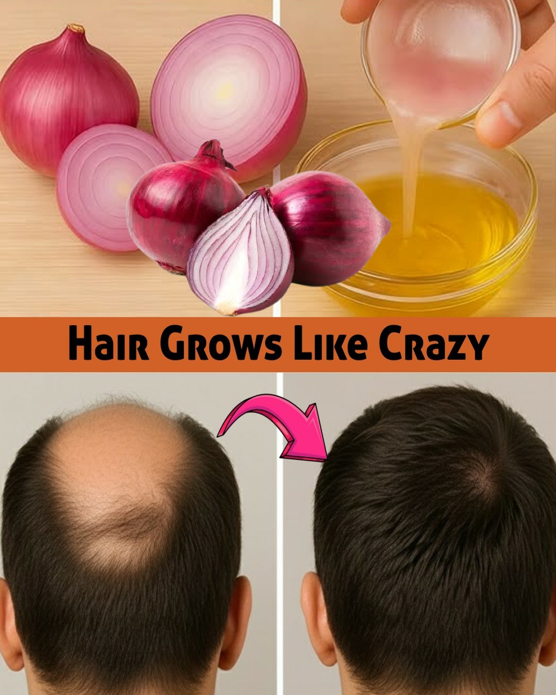 How to make onion Oil for fast hair growth and hair loss prevention