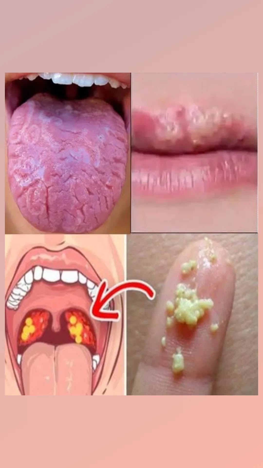 Struggling with Common Oral Health Issues? Here's What They Mean and How to Address Them Gently and Effectively