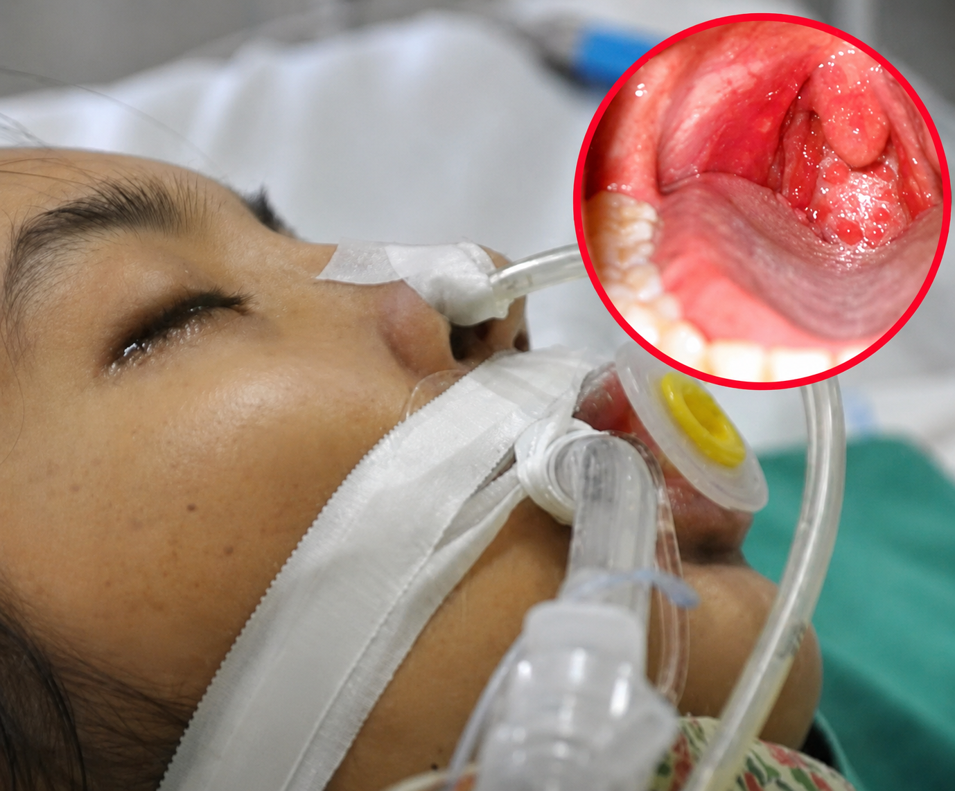 Doctors Warn: If You Have These 5 Symptoms Along With a Sore Throat, Seek Medical Attention Immediately