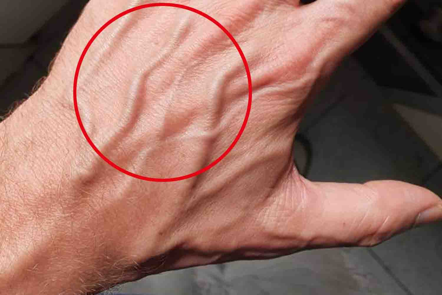 If Your Hand Veins Are Bulging or More Noticeable, Don’t Ignore These Possible Causes