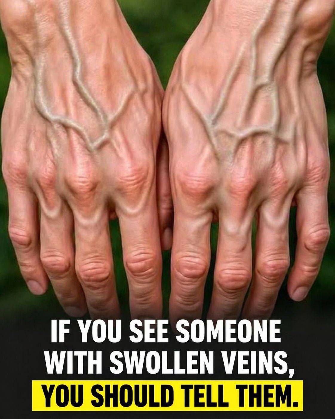 If your veins are visible, it means you are… See more