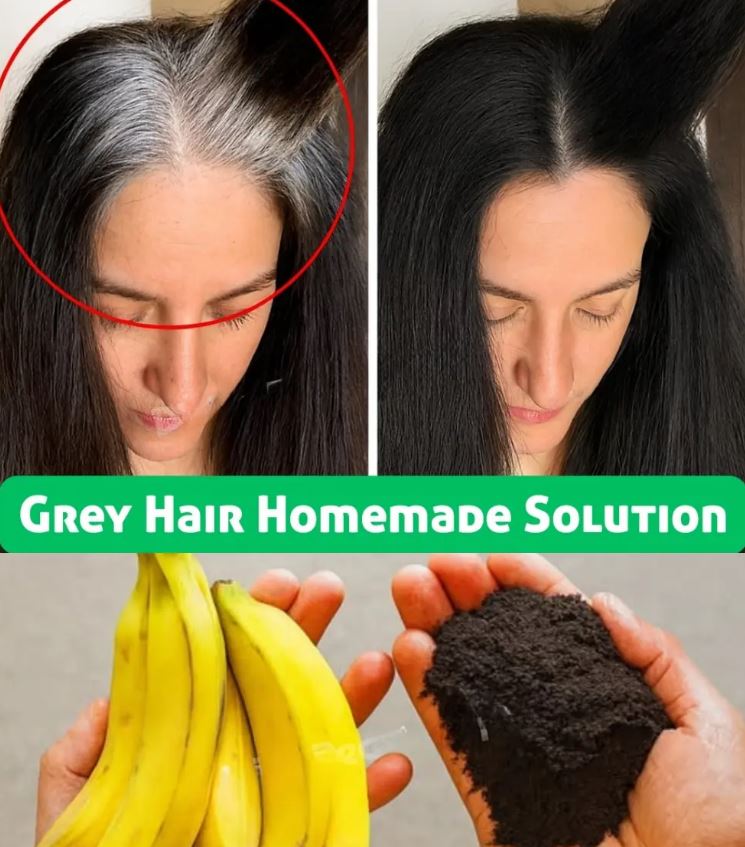 Improve Your Oral Health Naturally with Garlic