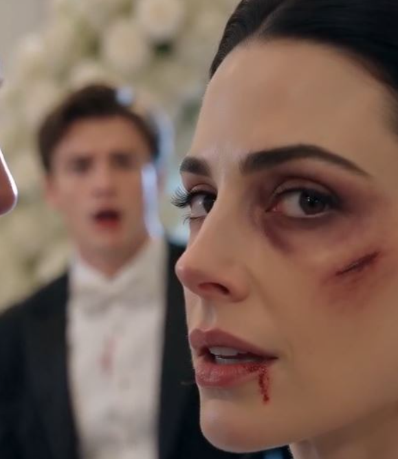 “Who Dared to Lay a Hand on My Daughter?” — Then the Bride Shocked Everyone by Demanding the Wedding Continue