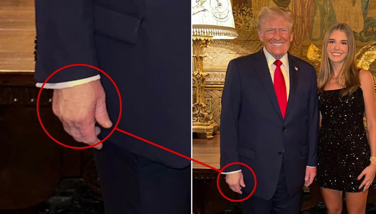 Trump’s Granddaughter Accidentally Reveals How Long He’s Had Hand Issues