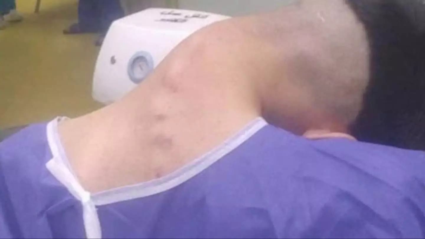HT15. Young man hospitalized because he dropped his ca…See more