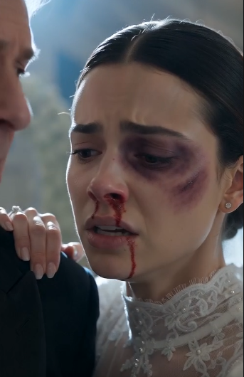 The Groom Beat His Bride Before the Wedding—Then She Calmly Said, "Continue the Ceremony."