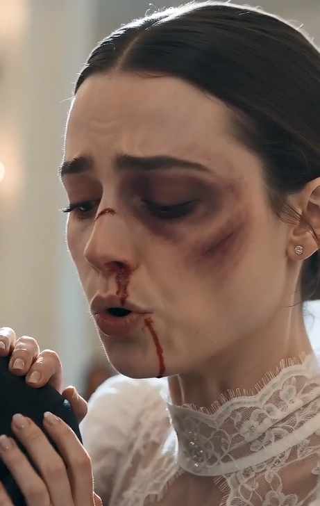 The Groom Beat His Bride Before the Wedding—Then She Calmly Said, "Continue the Ceremony."