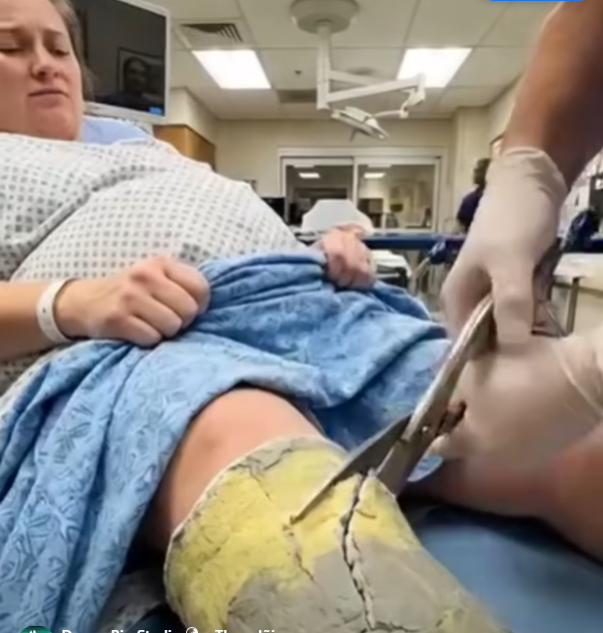 I Was About To Cut A Pregnant Woman’s Strange Leg Cast In The ER