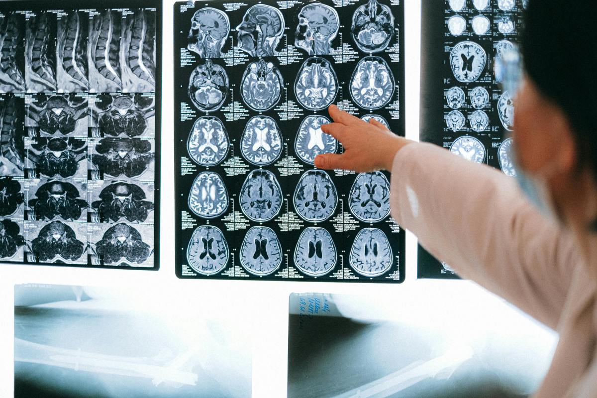 Internet On Edge After Trump Reveals The Results Of His MRI Scan