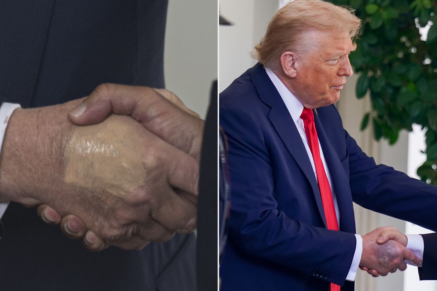 Why Has Donald Trump Been Hiding His Right Hand? The Subtle Details That Sparked Quiet Concern