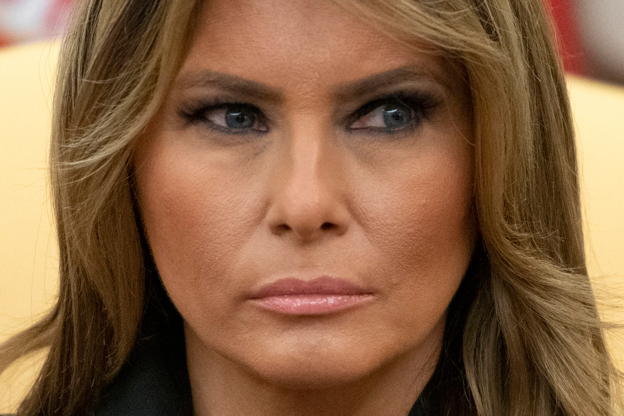 “Why Melania Trump’s Eyes Look Different in Photos: The Real Reason Behind the Online Debate”