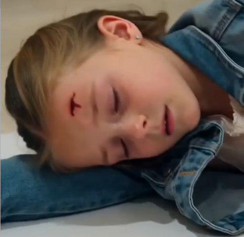 The solid oak chair struck eight-year-old Sophie near the temple and shattered against the wedding aisle.