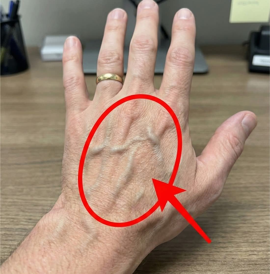 If you have visible vein, it means you are…