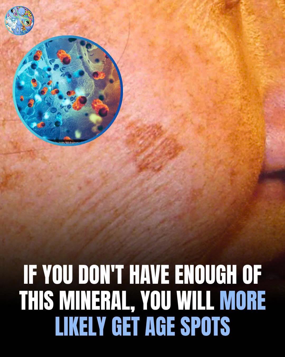 If You Don’t Have Enough of This Mineral, You Will More Likely Get Age Spots