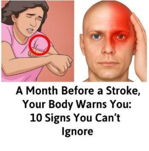 “10 Signs a Month Before a Stroke”? Dangerous Myth — Here’s What Science Actually Says