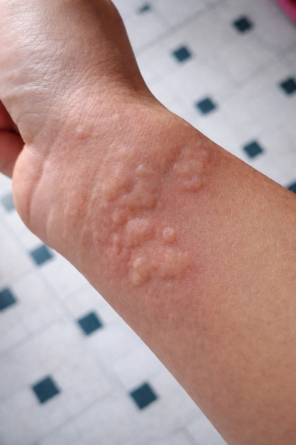These are the consequences of sleeping with…