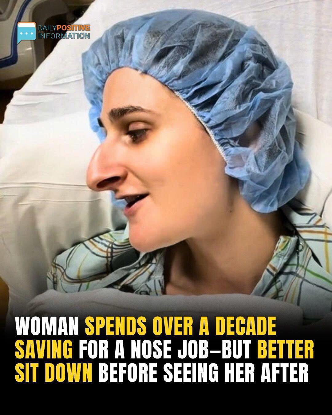 Woman Spends Over A Decade Saving For A Nose Job—But Better Sit Down Before Seeing Her After